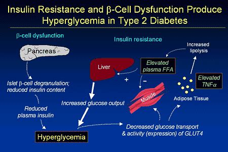 Beta Cell Dysfunction and Insulin Resistance .
